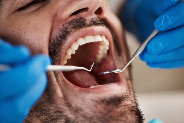 Best Urgent Tooth Repair  in Croydon, PA